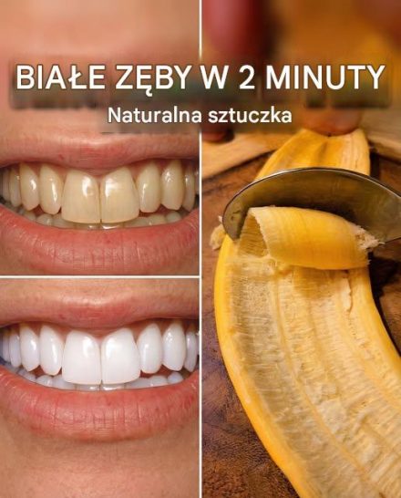 Koniec z drogimi zabiegami: Ten naturalny składnik, który masz już w swojej kuchni, usuwa kamień nazębny i w mgnieniu oka przywraca