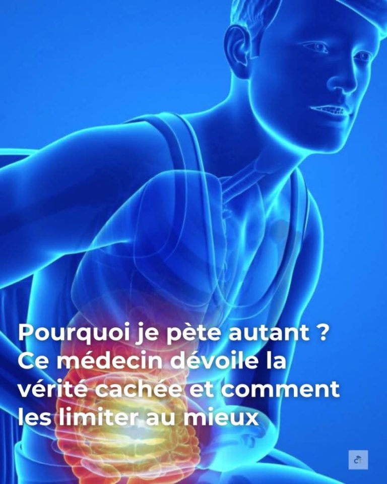 Dlaczego tak dużo pierdzę: najczęstsze uszkodzenia i proste rozwiązania