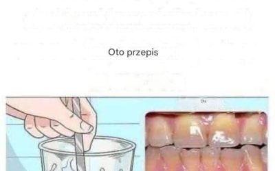 Usuń płytkę nazębną i wybiel zęby dzięki temu prostemu przepisowi. onApril 19, 2026