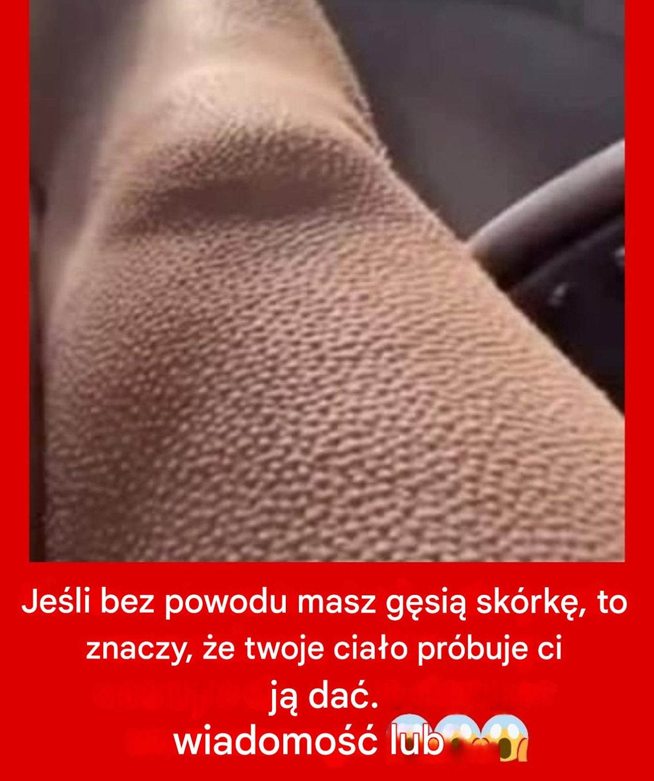 Skąd bierze się to dziwne uczucie gęsiej skórki?  Nie panikuj: te drobne mrowienia na skórze to całkowicie normalna reakcja fizjologiczna. Niezależnie od tego, czy jest to spowodowane zimnem, czy silną emocją (nagłym strachem, chwilą muzycznej gracji, poruszającą sceną filmową…), Twój organizm produkuje adrenalinę. Powód? Aktywują się mięśnie napinające włosy – te mikrowłókna znajdujące się u ich podstawy. Włosy stają dęba, nadając skórze charakterystyczny, ziarnisty wygląd.  Jednak to zjawisko nie ogranicza się do zimowych dreszczy czy przypływów adrenaliny. Czasami te drobne guzki pojawiają się bez wyraźnego powodu… i tu właśnie zagadka się pogłębia.  Następny »