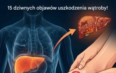 8 sygnałów ostrzegawczych, że Twoja wątroba jest pełna toksyn i powoduje przybieranie na wadze