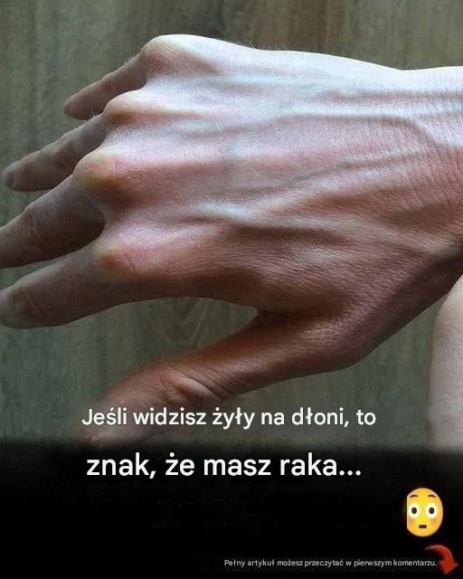 Widoczne żyły – wyjaśnienie: typowe przyczyny, zagrożenia dla zdrowia i kiedy należy się martwić.