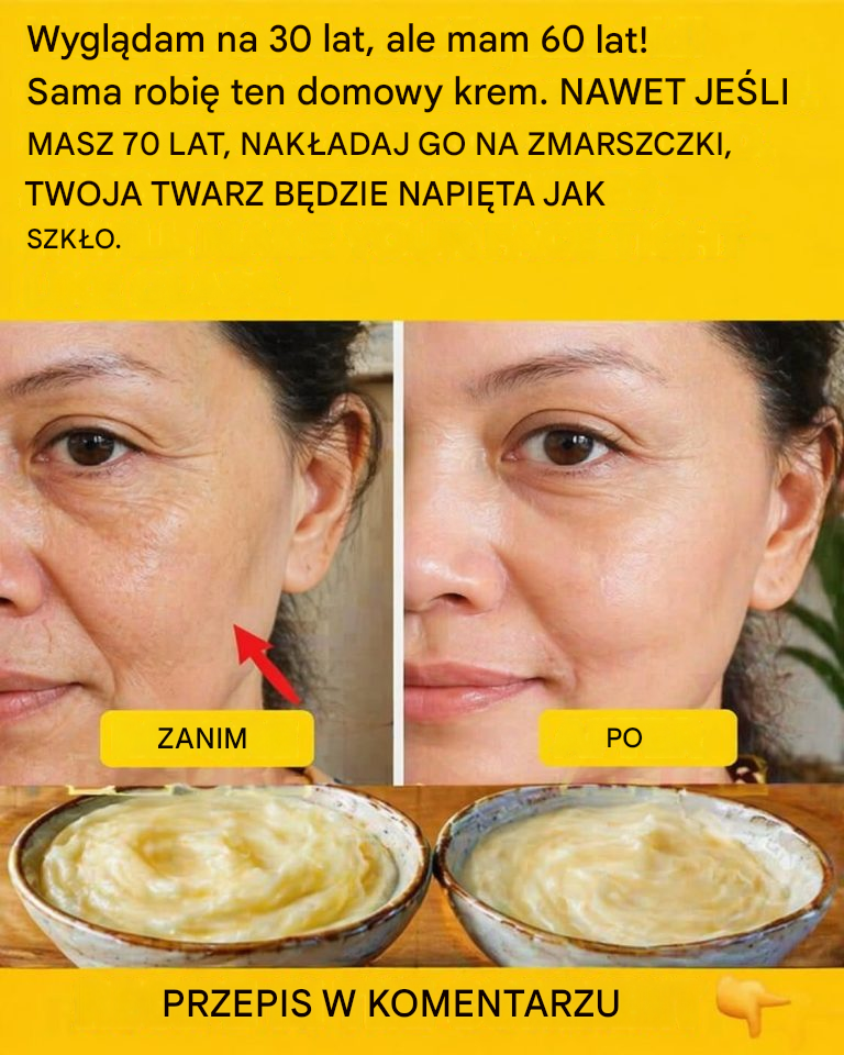 Przygotuj krem ​​z sody oczyszczonej i nałóż go przed snem. Żegnajcie zmarszczki i niedoskonałości… Aby nadal otrzymywać moje przepisy, wystarczy coś napisać… Dziękuję!