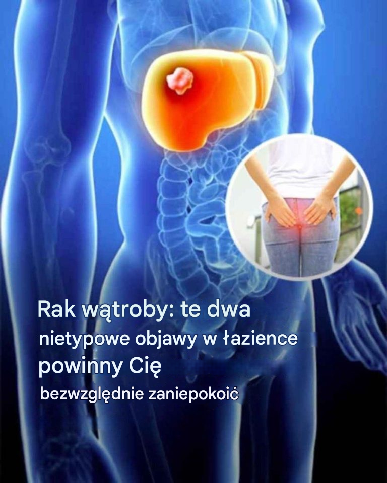 Rak wątroby: objawy tej choroby, która spowodowała śmierć Thierry’ego Ardissona