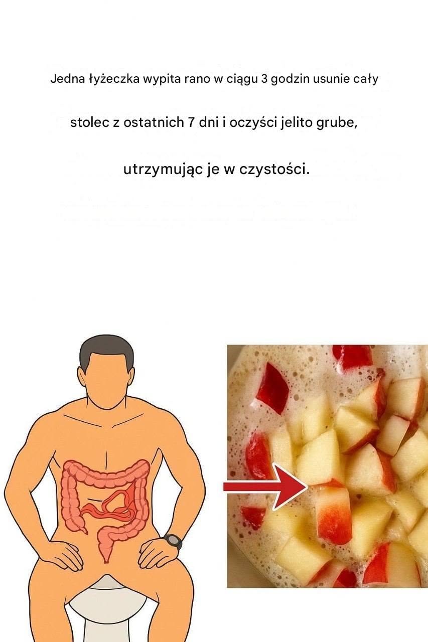 Zaparcia: Oto 3 naturalne sposoby na poprawę pracy jelit, według dietetyka.