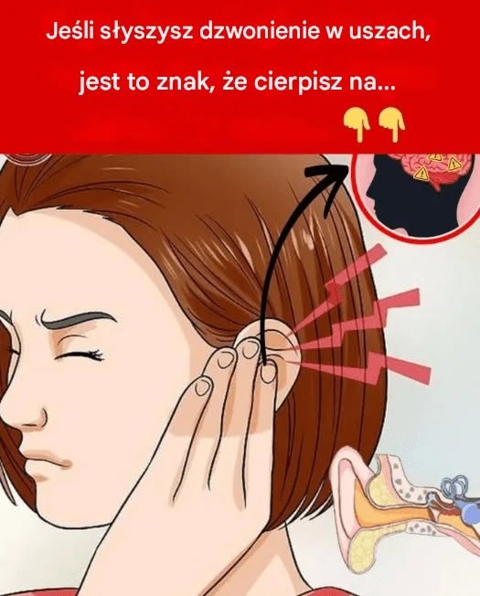 Jeśli słyszysz dzwonienie w uchu, może to być oznaką, że cierpisz na…